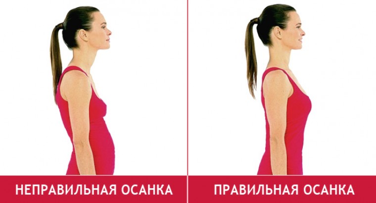 Правильная и неправильная осанка